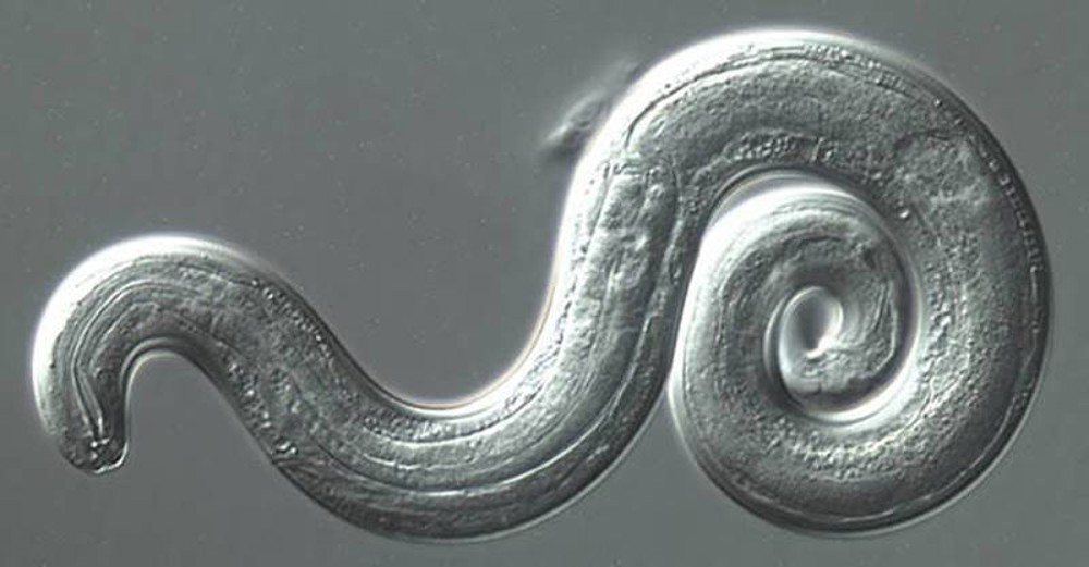 Scientists warn that parasitic brain worm is being seen in the Southeast US