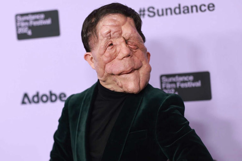 Adam Pearson criticizes limited roles for people with disabilities: ‘Lazy writing’